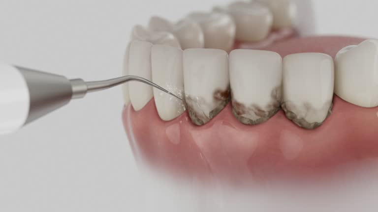 Reliable Dental contractor in Marietta, OH by Dentist Open Now
